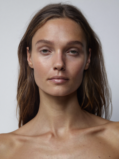 Dermal filler treatment London natural facial contouring results