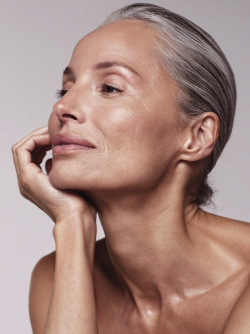 Radiesse collagen stimulating filler treatment London