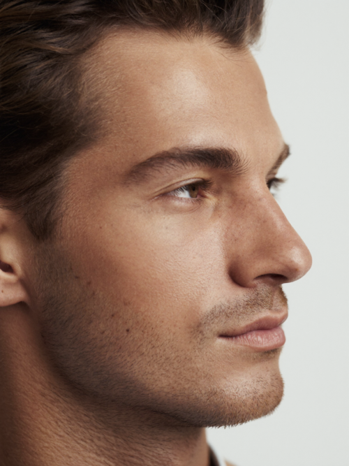 Non-surgical rhinoplasty London nose reshaping treatment